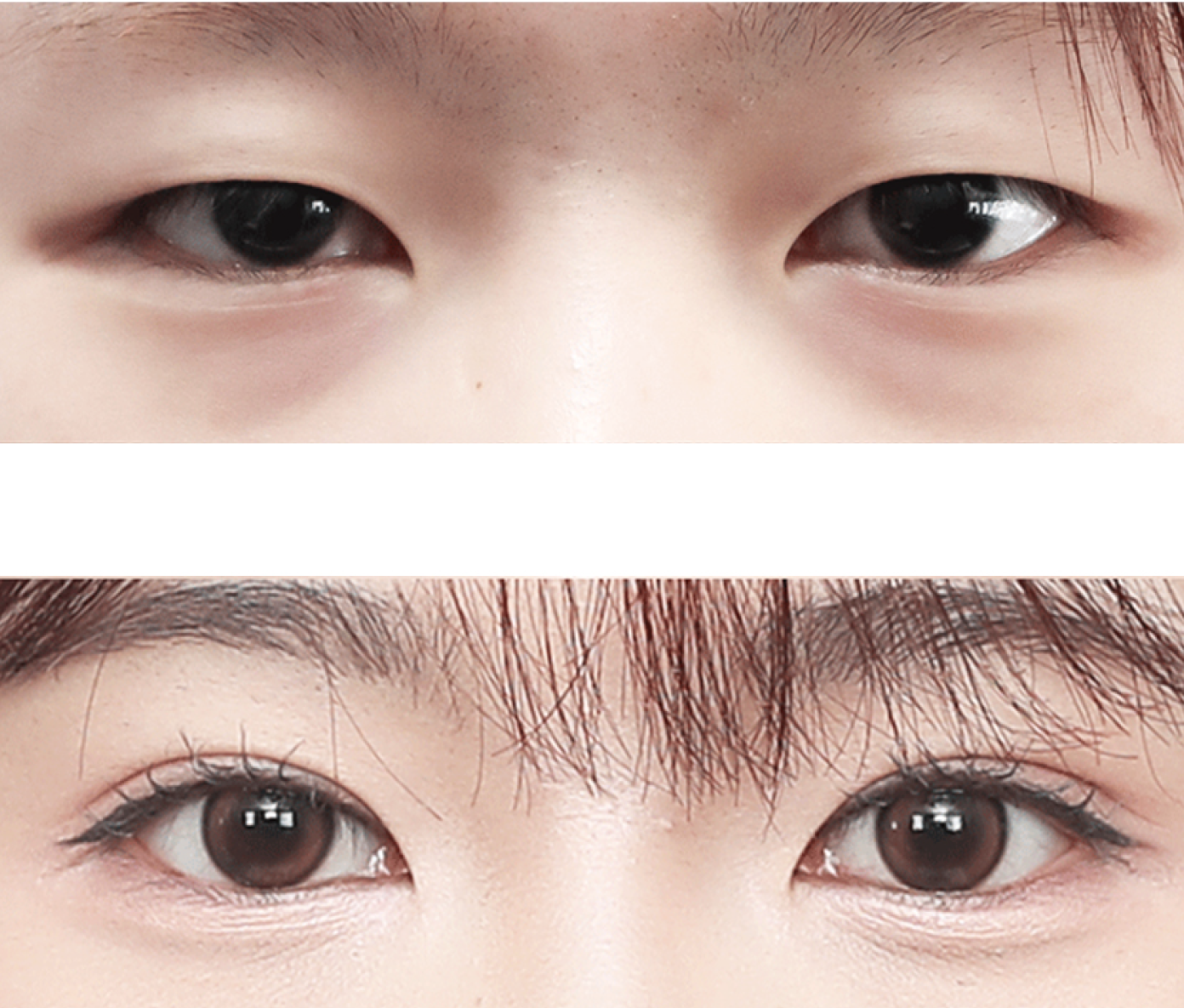 Plastic Surgery in Busan