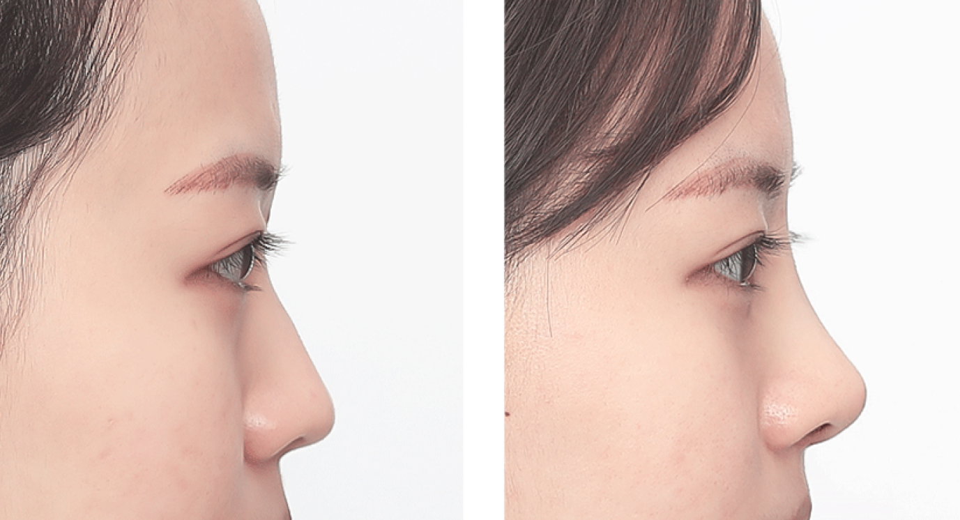 Plastic Surgery in Busan