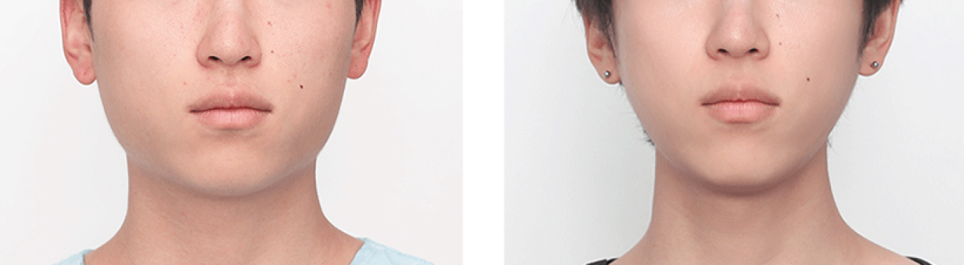 Best Plastic Surgery in Busan