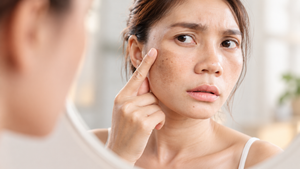 Pigmentation Treatment in Busan